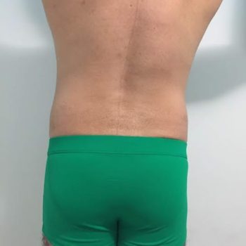 92